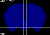 ABA expression energy