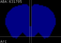 ABA expression energy