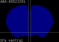 ABA expression energy