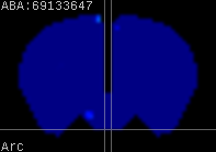 ABA expression energy