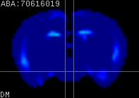 ABA expression energy