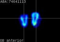 ABA expression energy
