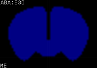 ABA expression energy