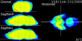 ViBrism