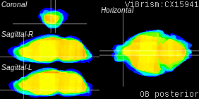 ViBrism