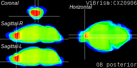ViBrism