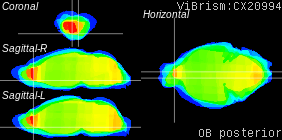 ViBrism