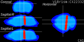 ViBrism