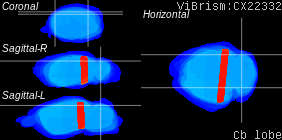 ViBrism