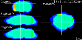 ViBrism