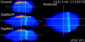 ViBrism