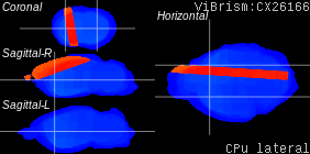 ViBrism