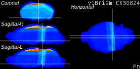 ViBrism