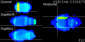ViBrism