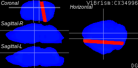 ViBrism