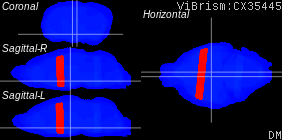 ViBrism