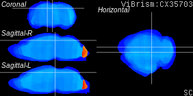 ViBrism